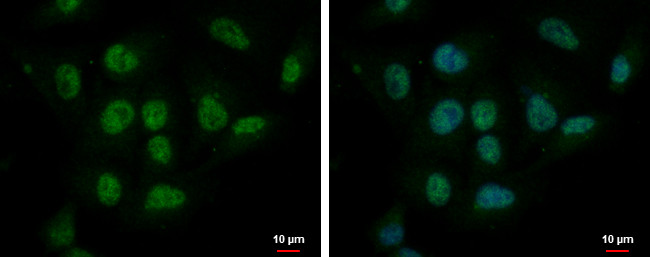 CBX6 Antibody in Immunocytochemistry (ICC/IF)