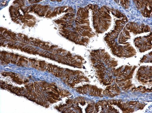 Centrin 3 Antibody in Immunohistochemistry (Paraffin) (IHC (P))