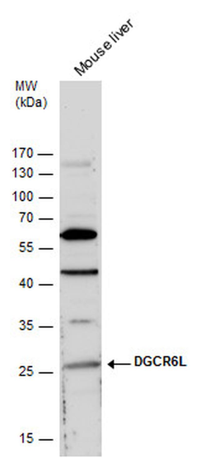 DGCR6L Antibody in Western Blot (WB)