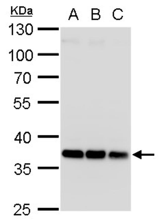 HOXD13 Antibody in Western Blot (WB)