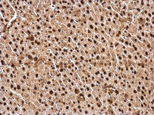 NFIA Antibody in Immunohistochemistry (Paraffin) (IHC (P))