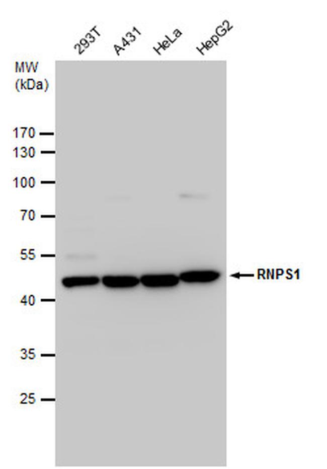 RNPS1 Antibody in Western Blot (WB)