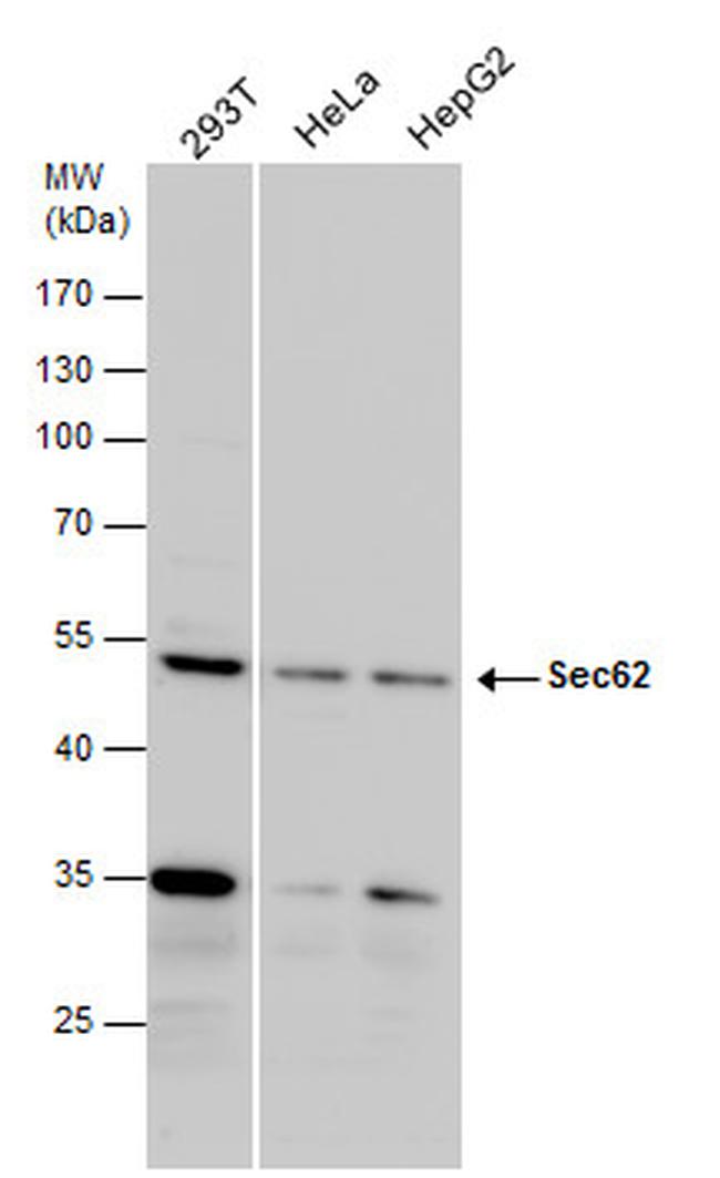 SEC62 Antibody in Western Blot (WB)