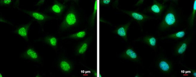 SP2 Antibody in Immunocytochemistry (ICC/IF)