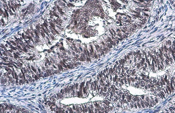 SP2 Antibody in Immunohistochemistry (Paraffin) (IHC (P))