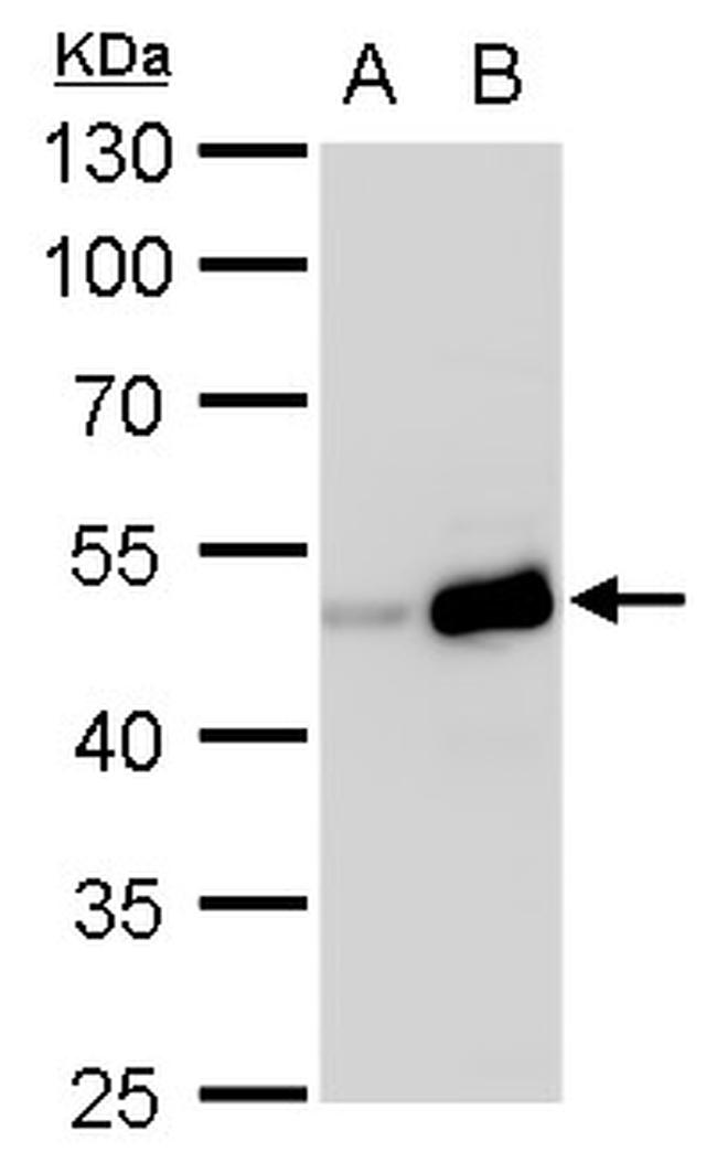 TIPIN Antibody in Western Blot (WB)
