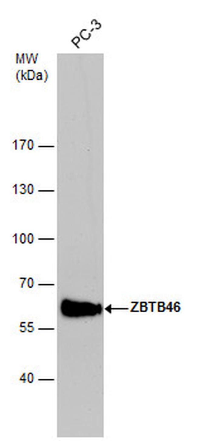 ZBTB46 Antibody in Western Blot (WB)