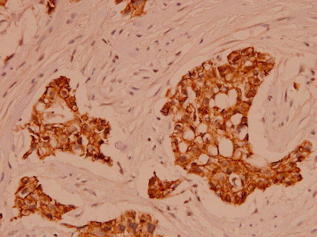 alpha Catenin Antibody in Immunohistochemistry (Paraffin) (IHC (P))