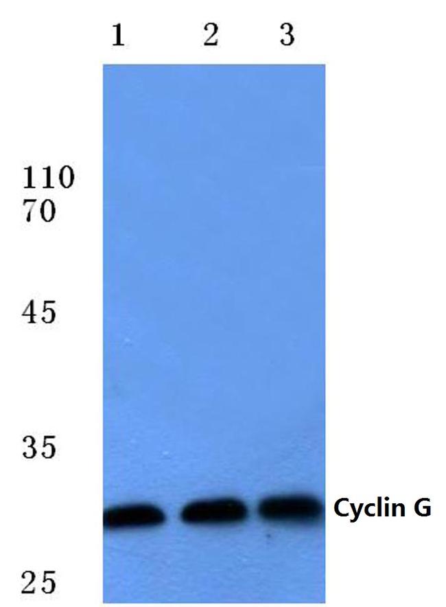 Cyclin G1 Antibody in Western Blot (WB)