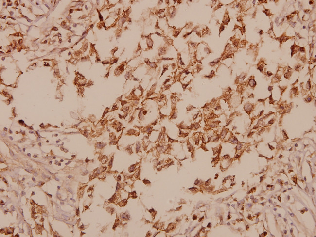 GAD67 Antibody in Immunohistochemistry (Paraffin) (IHC (P))