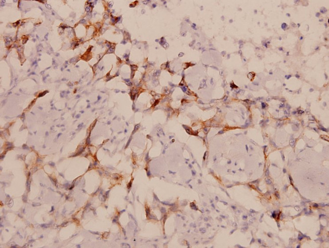 LIMK1/LIMK2 Antibody in Immunohistochemistry (Paraffin) (IHC (P))