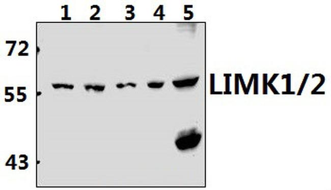 LIMK1/LIMK2 Antibody in Western Blot (WB)