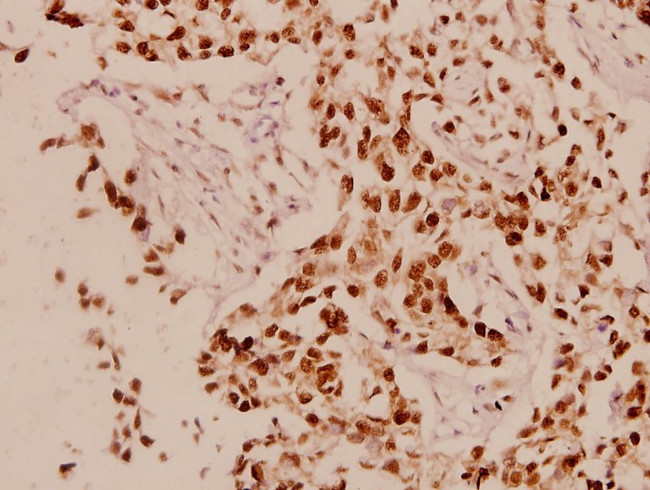 Cyclin L1 Antibody in Immunohistochemistry (Paraffin) (IHC (P))