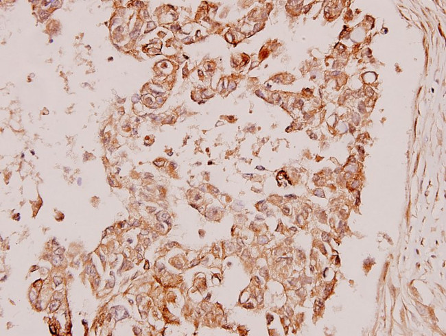 PDPK1 Antibody in Immunohistochemistry (Paraffin) (IHC (P))