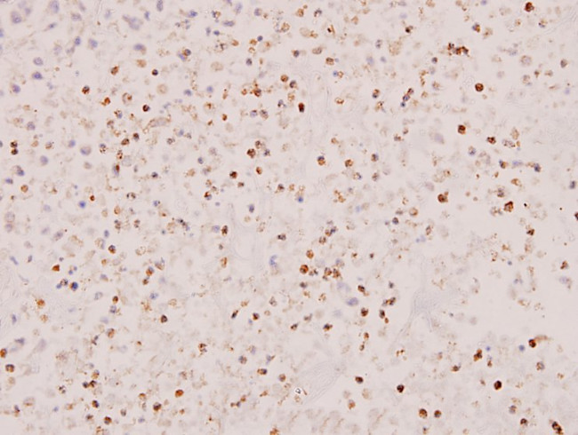 STAT5 alpha/beta Antibody in Immunohistochemistry (Paraffin) (IHC (P))