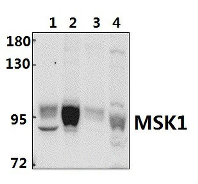 MSK1 Antibody in Western Blot (WB)