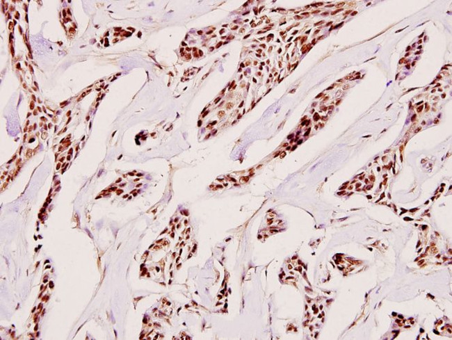 H1FOO Antibody in Immunohistochemistry (Paraffin) (IHC (P))