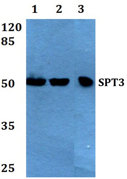 SPT3 Antibody in Western Blot (WB)