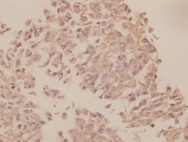 UBF-1 Antibody in Immunohistochemistry (Paraffin) (IHC (P))