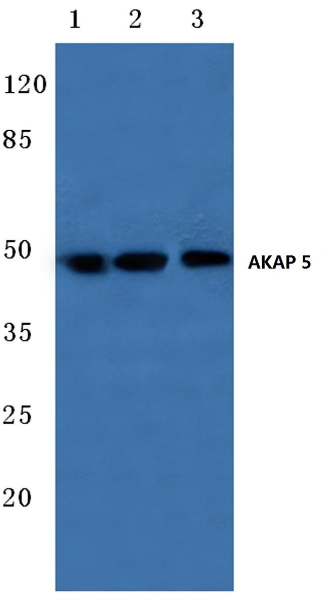 AKAP5 Antibody in Western Blot (WB)
