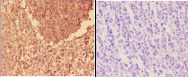 alpha Actinin 3 Antibody in Immunohistochemistry (Paraffin) (IHC (P))