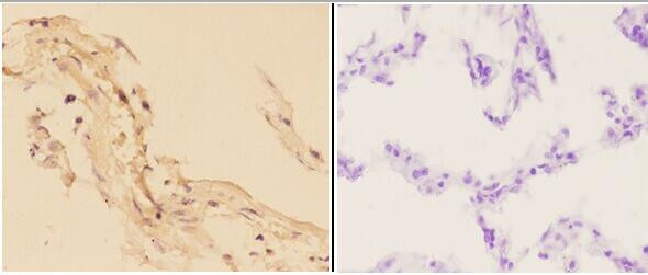 alpha Actinin 3 Antibody in Immunohistochemistry (Paraffin) (IHC (P))