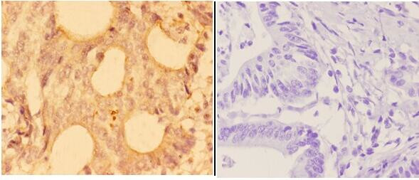 alpha Actinin 3 Antibody in Immunohistochemistry (Paraffin) (IHC (P))