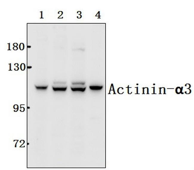 alpha Actinin 3 Antibody in Western Blot (WB)