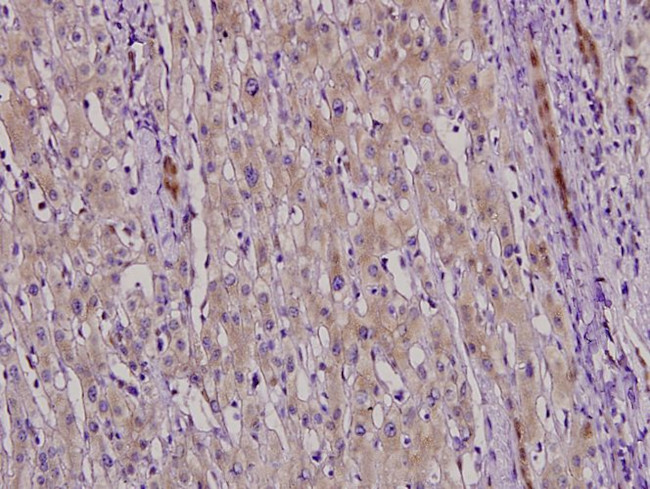 NFYC Antibody in Immunohistochemistry (Paraffin) (IHC (P))