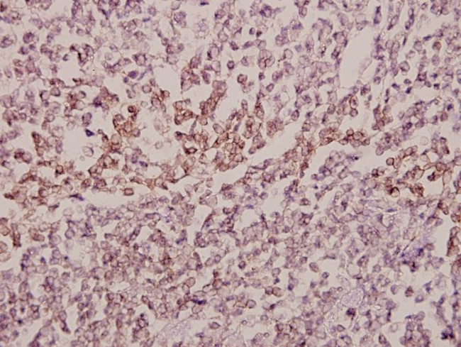 MID1 Antibody in Immunohistochemistry (Paraffin) (IHC (P))