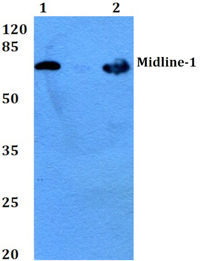 MID1 Antibody in Western Blot (WB)