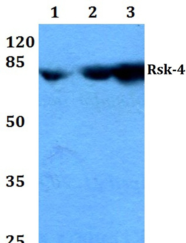 RSK4 Antibody in Western Blot (WB)