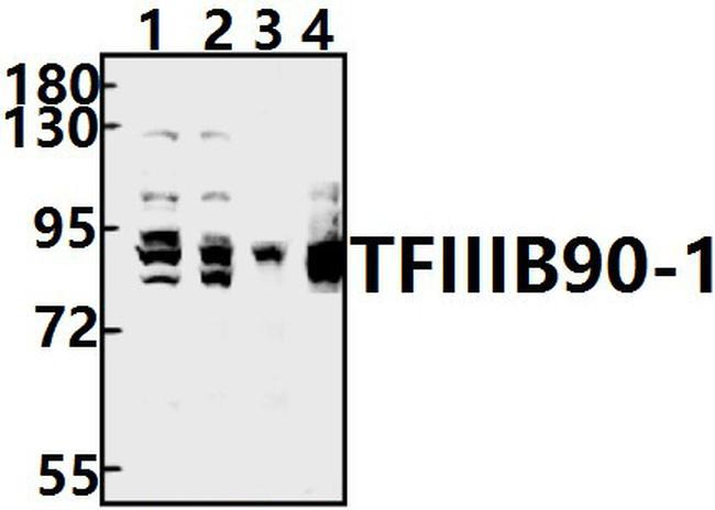 BRF1 Antibody in Western Blot (WB)