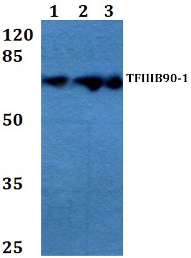 BRF1 Antibody in Western Blot (WB)