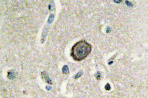 CDH8 Antibody in Immunohistochemistry (Paraffin) (IHC (P))