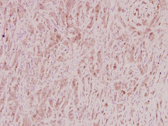 ZNF23 Antibody in Immunohistochemistry (Paraffin) (IHC (P))