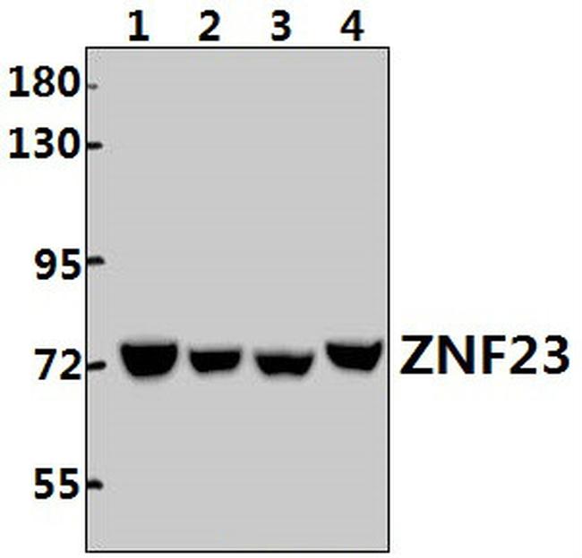 ZNF23 Antibody in Western Blot (WB)