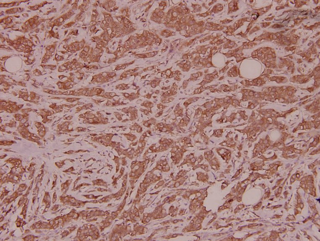 SPIN1 Antibody in Immunohistochemistry (Paraffin) (IHC (P))