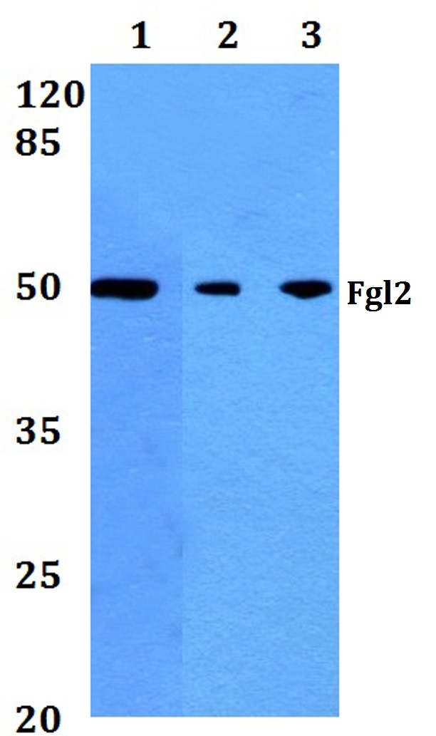 FGL2 Antibody in Western Blot (WB)