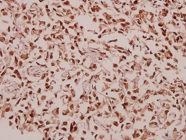 RPL39 Antibody in Immunohistochemistry (Paraffin) (IHC (P))