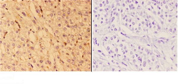 ACOT2 Antibody in Immunohistochemistry (Paraffin) (IHC (P))