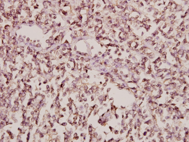 Arfaptin 1 Antibody in Immunohistochemistry (Paraffin) (IHC (P))