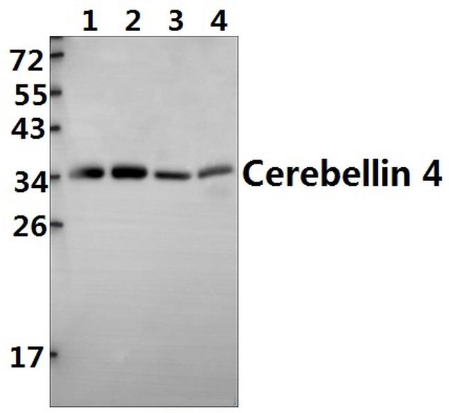 Cerebellin 4 Antibody in Western Blot (WB)