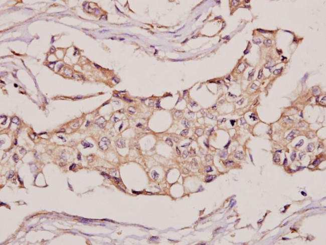 CYB5R3 Antibody in Immunohistochemistry (Paraffin) (IHC (P))