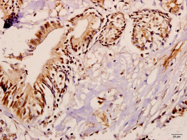 ME3 Antibody in Immunohistochemistry (Paraffin) (IHC (P))