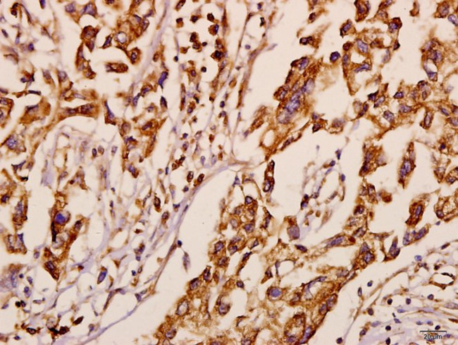 NEURL1 Antibody in Immunohistochemistry (Paraffin) (IHC (P))