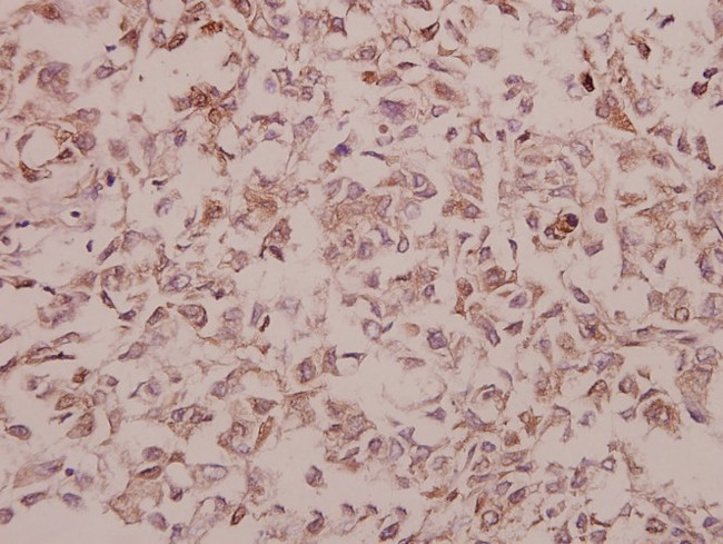 NSG1 Antibody in Immunohistochemistry (Paraffin) (IHC (P))