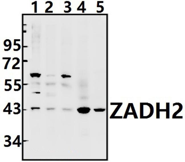 ZADH2 Antibody in Western Blot (WB)