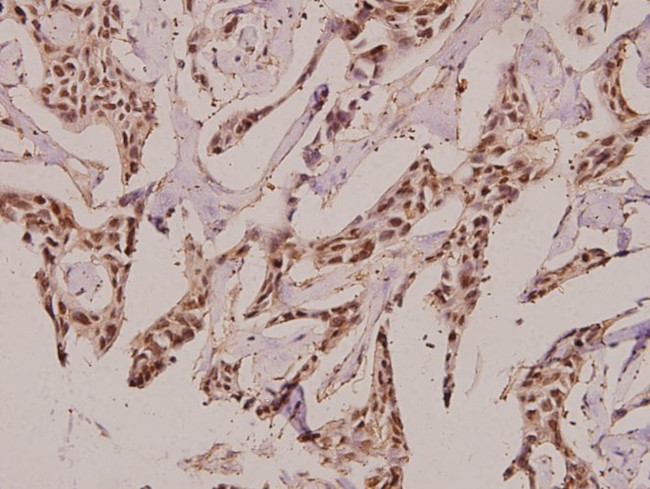 GUCY1B2 Antibody in Immunohistochemistry (Paraffin) (IHC (P))