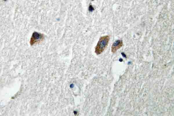 CaMKII beta/gamma/delta Antibody in Immunohistochemistry (Paraffin) (IHC (P))